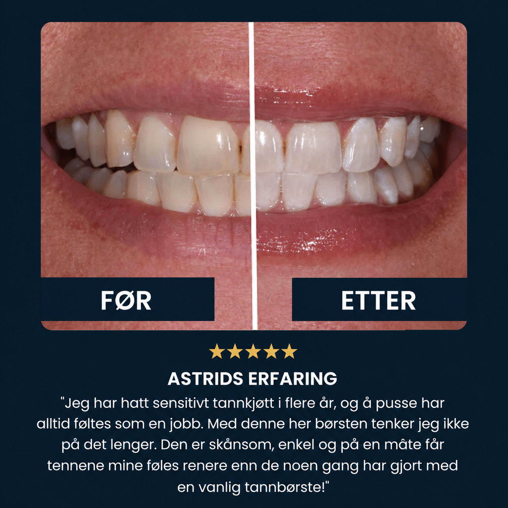 FjordSmile - Et vakkert smil på 30 sekunder