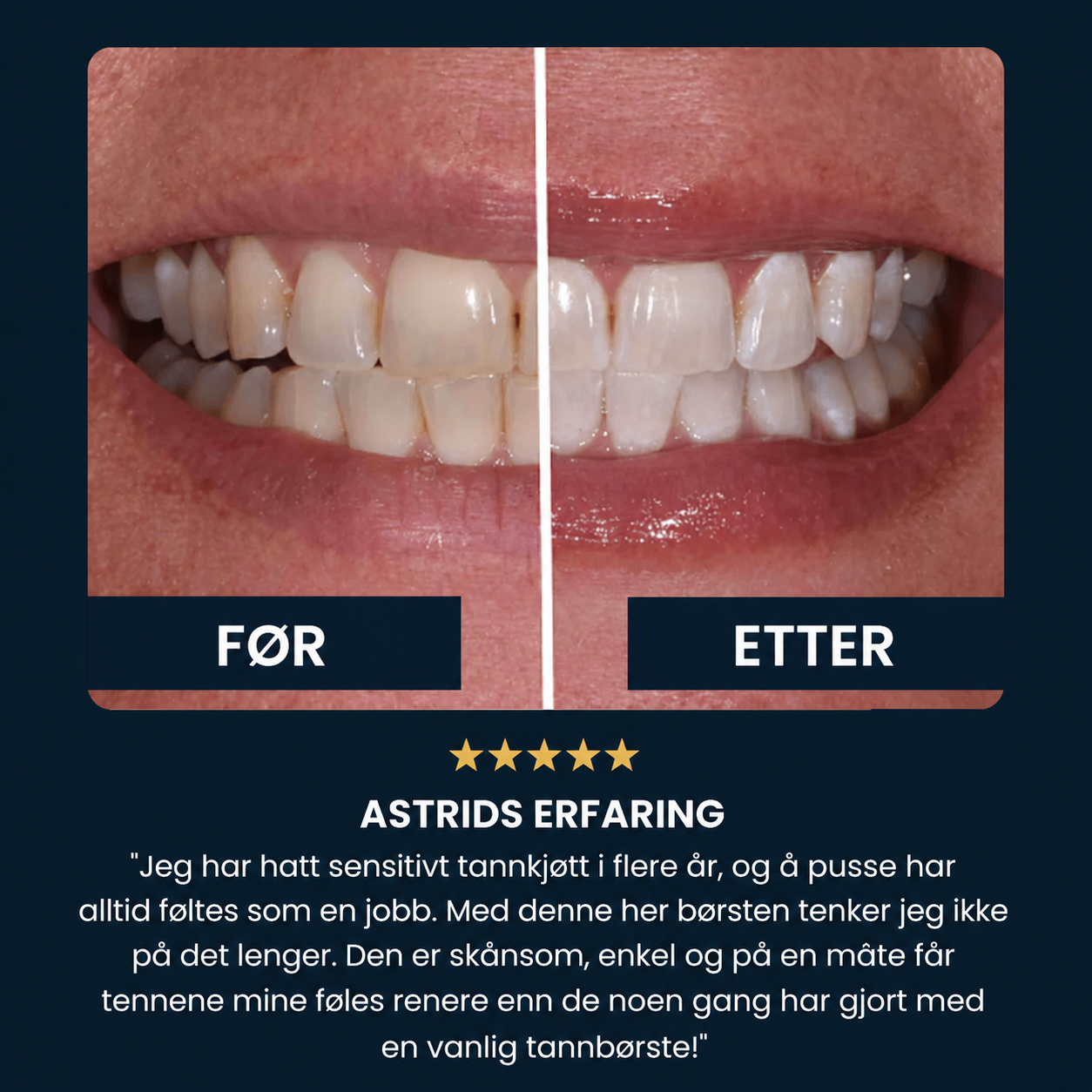 FjordSmile - Et vakkert smil på 30 sekunder