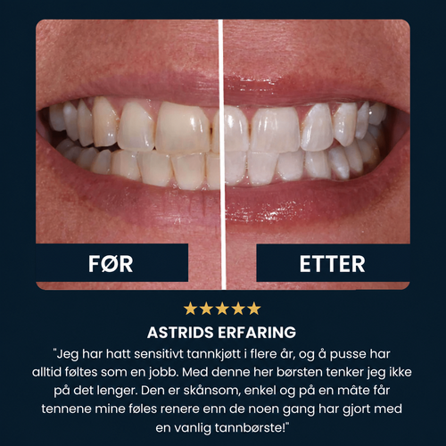 FjordSmile - Et vakkert smil på 30 sekunder